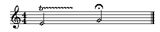 Picture of Mup output